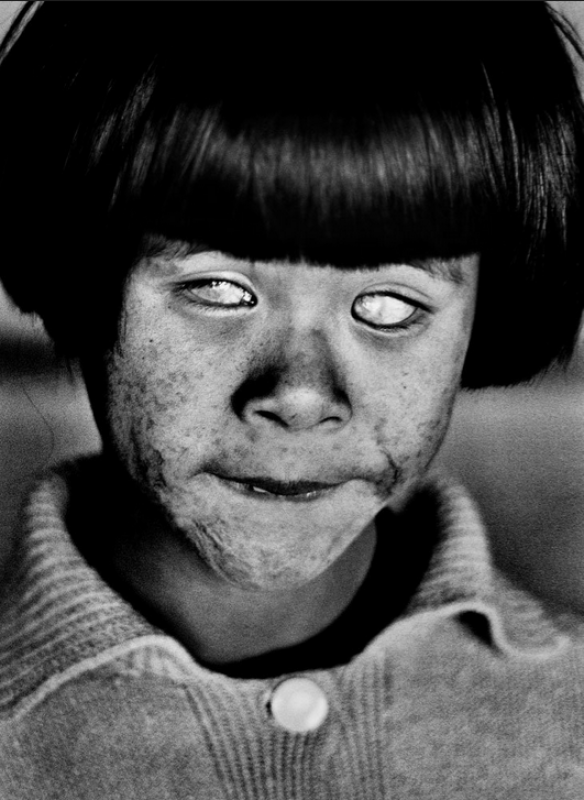 Christer Strömholm, The blind girl, Hiroshima,1961, Japan